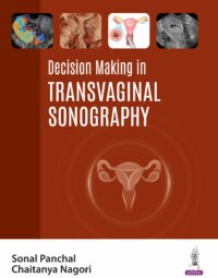 Decision Making in Transvaginal Sonography