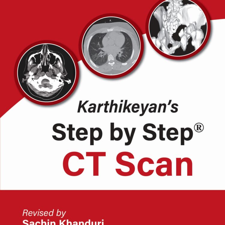 Karthikeyan's Step by Step CT Scan