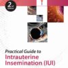 Practical Guide to Intrauterine Insemination (IUI)