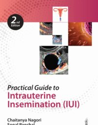 Practical Guide to Intrauterine Insemination (IUI)