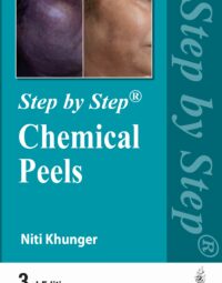 Step by Step Chemical Peels