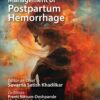 Practical Guide to Management of Postpartum Hemorrhage