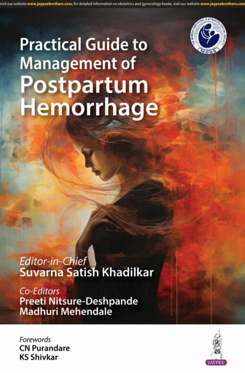 Practical Guide to Management of Postpartum Hemorrhage